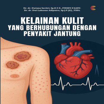 Kelainan Kulit yang Berhubungan dengan Penyakit Jantung